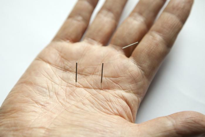 hand outstretched on a white background with two acupuncture needles piercing the palm. 